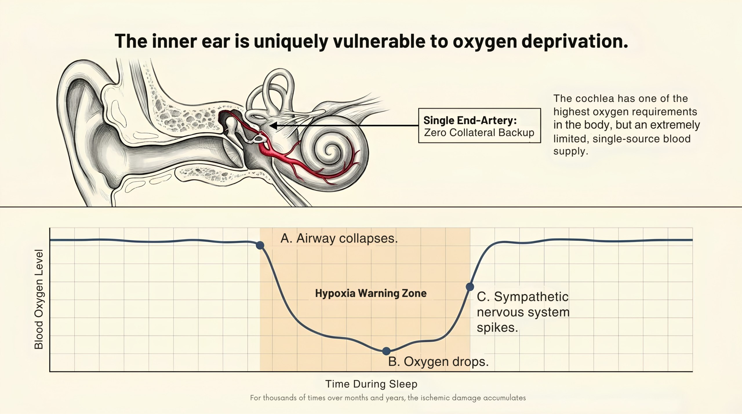 The inner ear is uniquely vulnerable to oxygen deprivation — diagram showing the cochlea's single end-artery blood supply and a graph of blood oxygen dropping during an apnea event